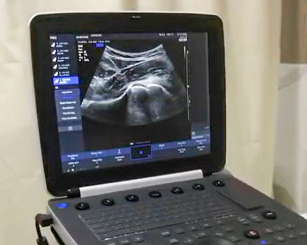 Procedimentos Guiados por USG